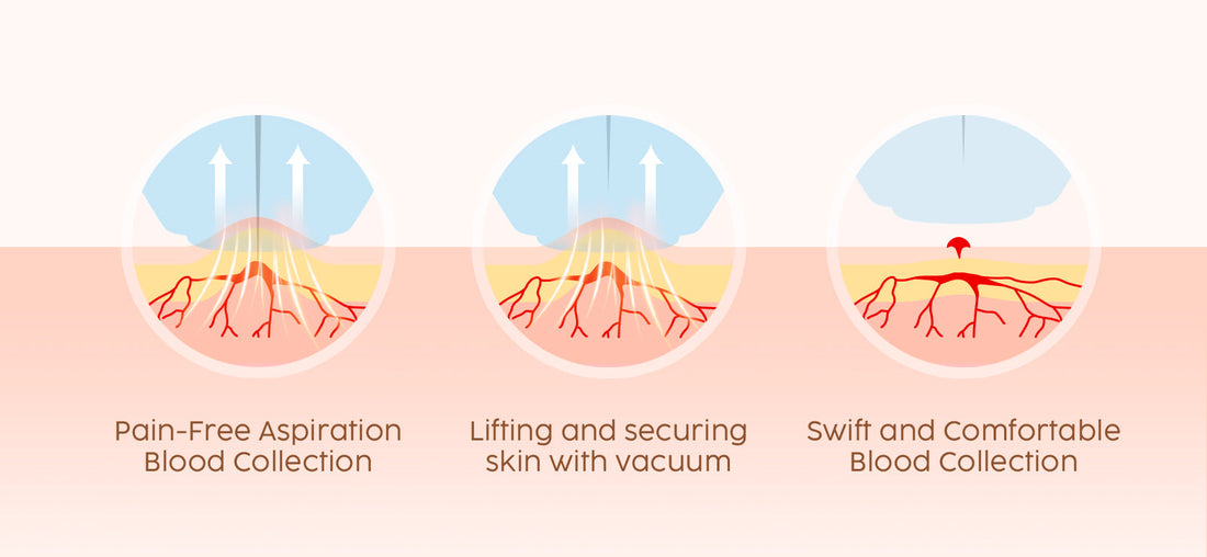 How to Use a Lancing Device for Blood Sugar Testing: Step-by-Step Guide